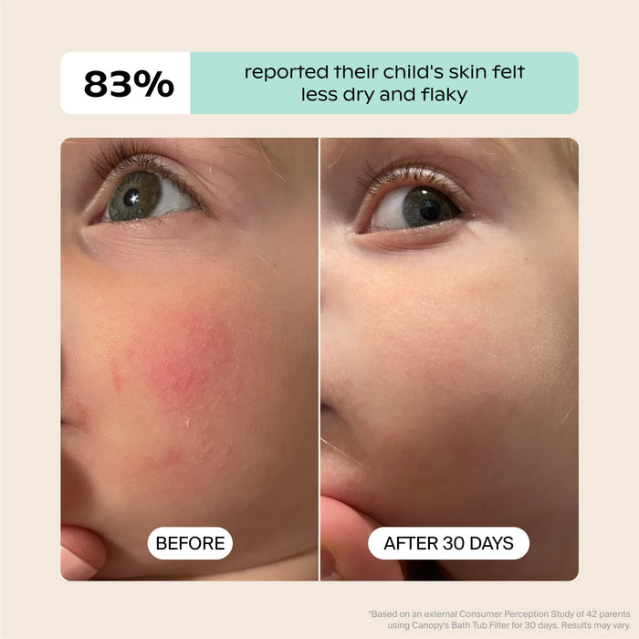 Tubby Todd x Canopy Bubbles & Cuddles Gift Set | Lifestyle, 83% reported their child's skin felt less dry and flaky