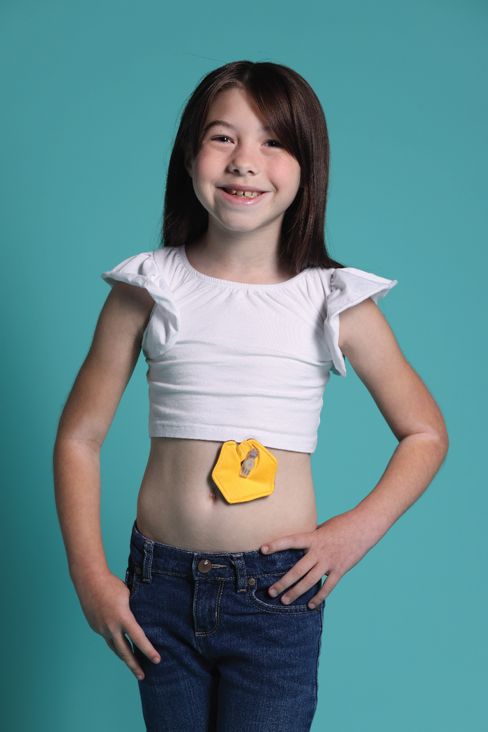 Girl wearing gold g-tube pad
